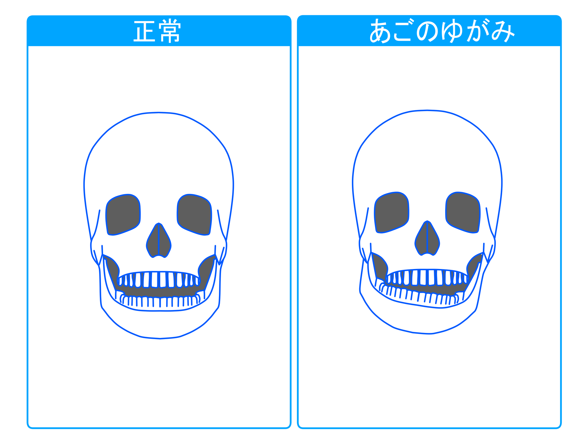 顎関節症について